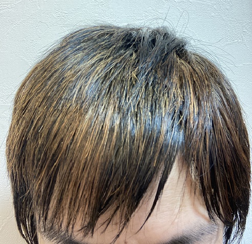 湯シャン生活7年1ヶ月目の頭髪の状態