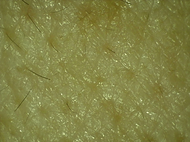 脱洗剤・肌断食生活8年8ヶ月目の左頬