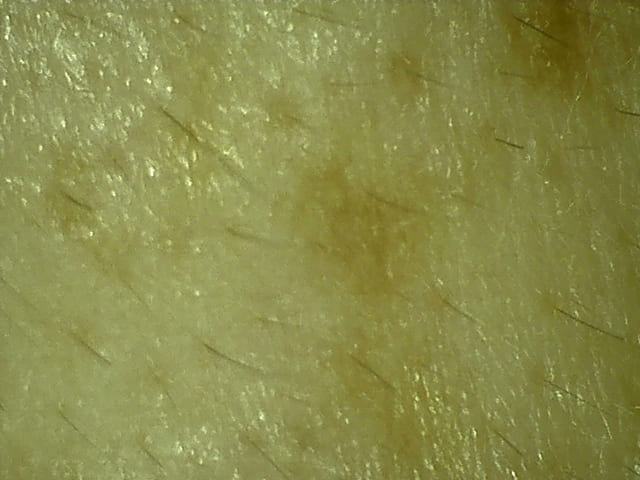 脱洗剤・肌断食生活8年8ヶ月目の左目尻