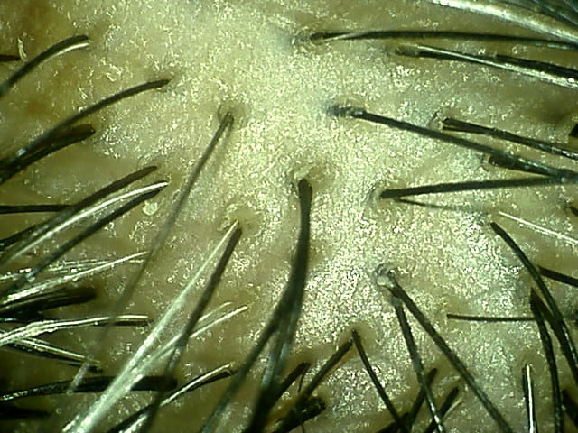 湯シャン生活8年8ヶ月目の天頂部