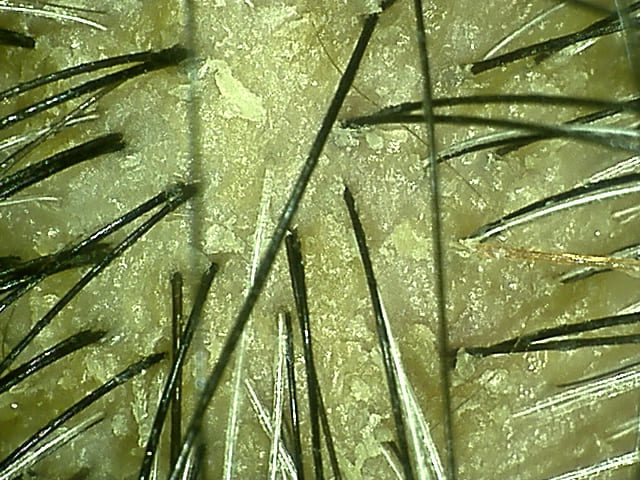 湯シャン生活8年8ヶ月目の頭頂部