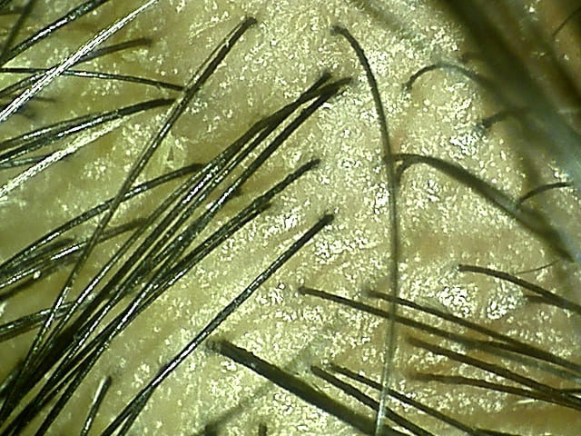 湯シャン生活8年8ヶ月目の前頭部