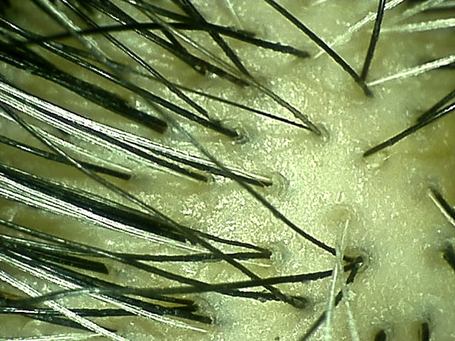 湯シャン生活9年3ヶ月目の天頂部