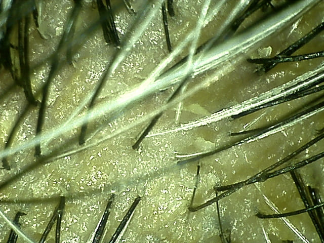 湯シャン生活9年3ヶ月目の頭頂部