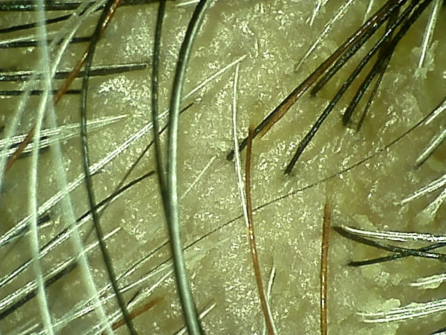 湯シャン生活9年3ヶ月目の前頭部