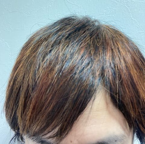 湯シャン生活9年3ヶ月目の頭髪の状態