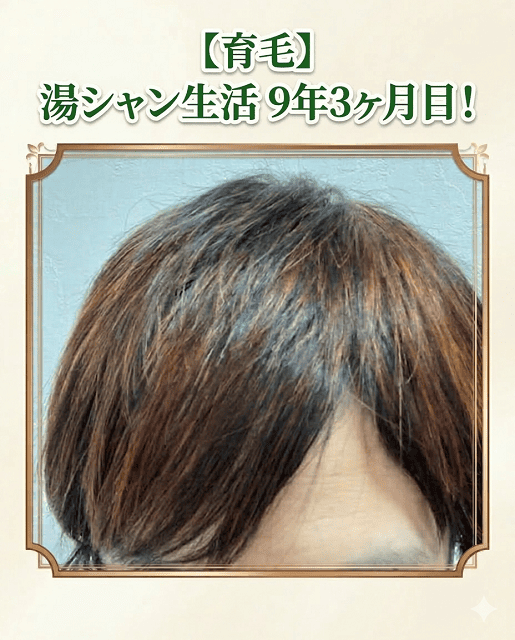 【育毛】湯シャン生活9年3ヶ月目!